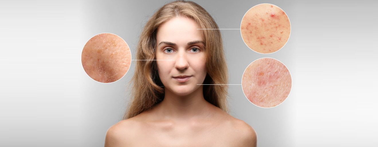 Makijaż korekcyjny - sztuka w służbie dermatologii