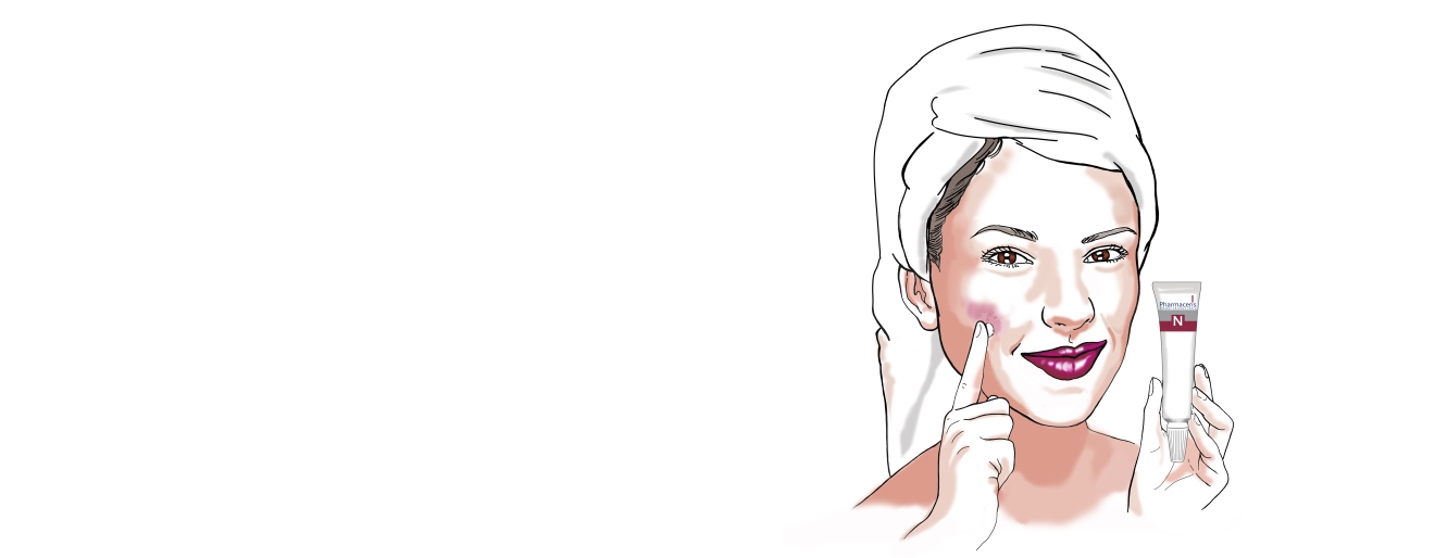 Jak łagodzić problemy cery naczynkowej?