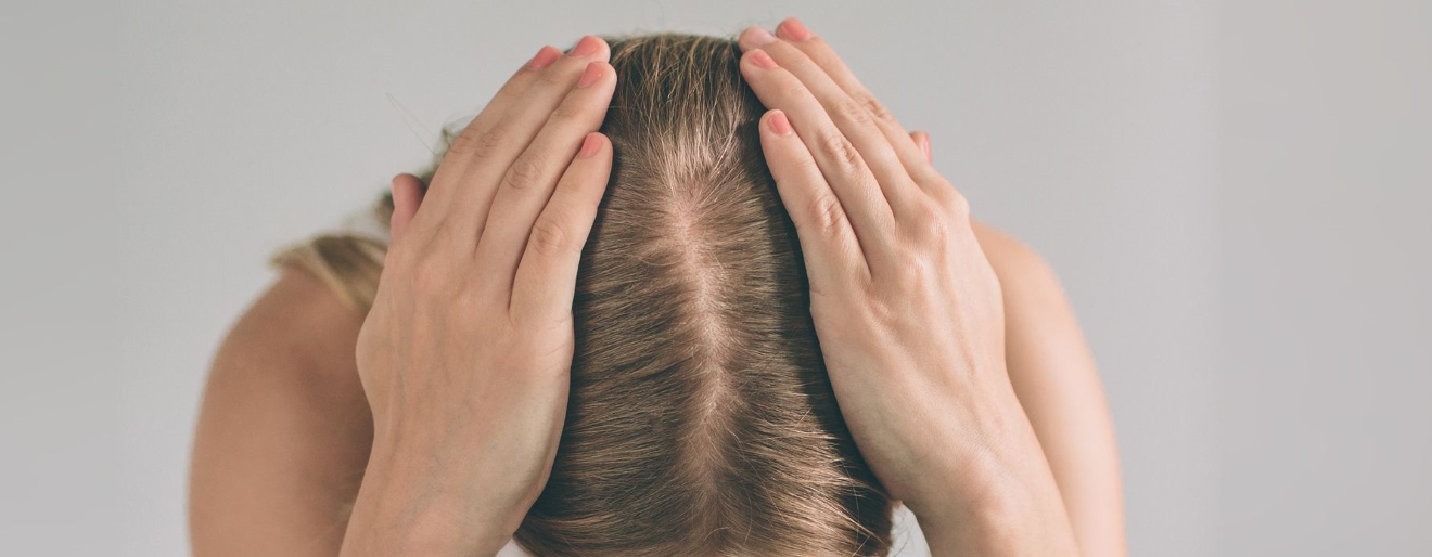 Łojotokowe zapalenie skóry głowy - łagodzenie objawów