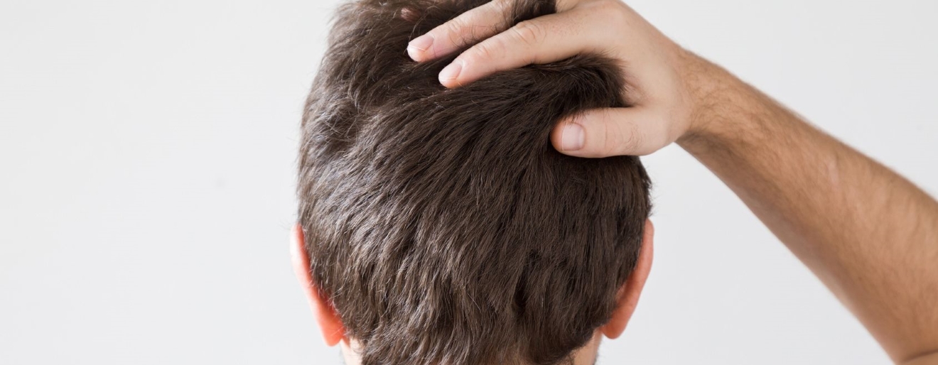 Łupież czy łuszczyca? Rozpoznanie i łagodzenie objawów