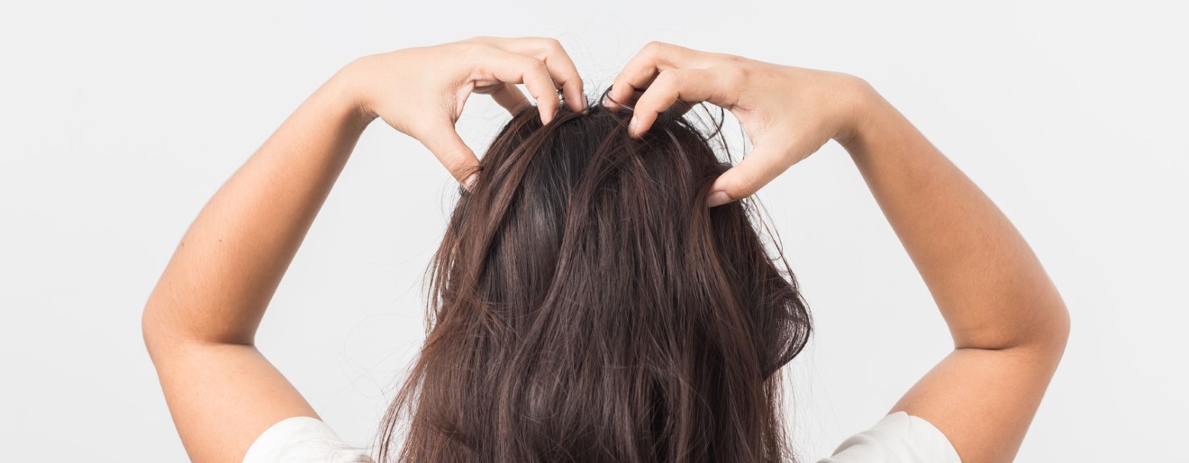 Oparzenia słoneczne skóry głowy - łagodzenie objawów