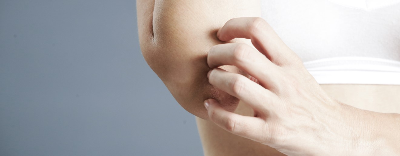 Jak wspomóc skórę w walce z łuszczycą?